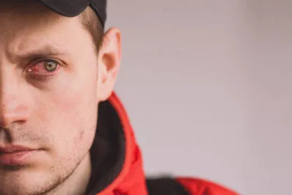 Qual droga deixa o olho vermelho: Veja os efeitos no corpo